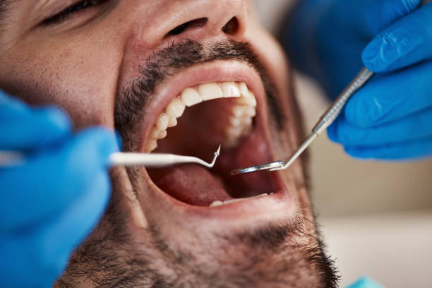 Best Cracked Tooth Emergency Dentist  in Combe, LA